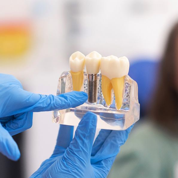A dentist pointing to a dental implant model